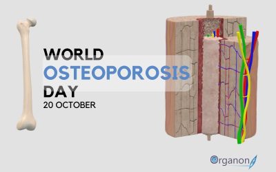 World Osteoporosis Day | 20 October