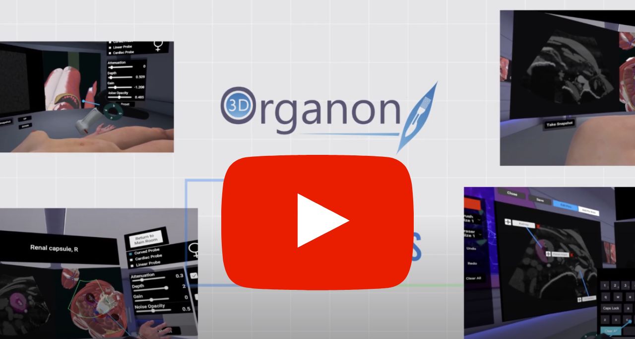 new ultrasound 3D Organon Ultrasound