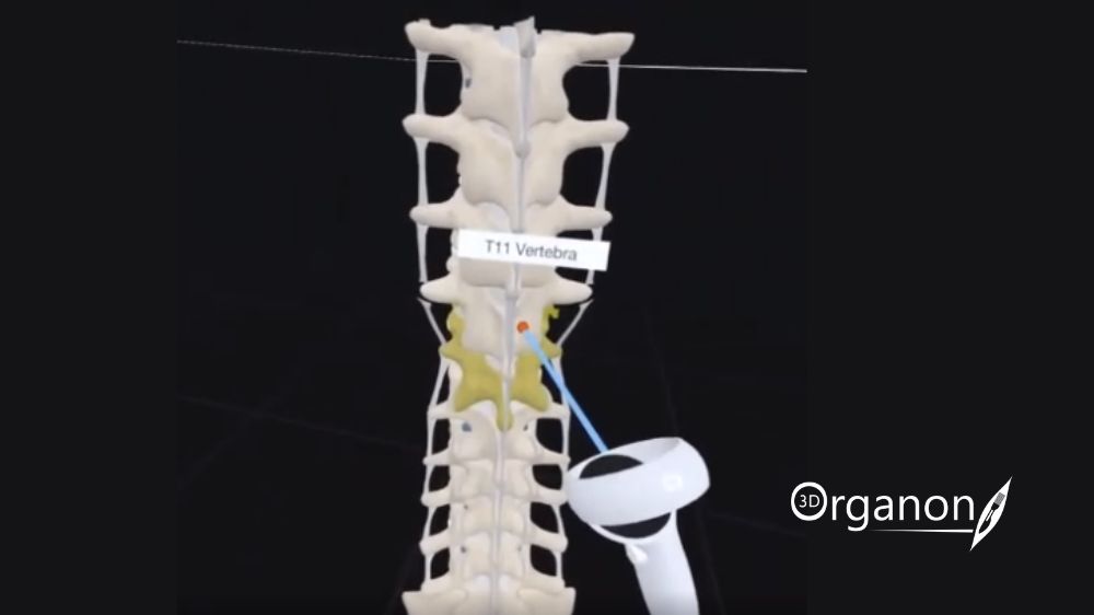 3D Organon for procedural planning. A visual representation showcasing the use of 3D Organon software for advanced procedural planning in medical settings