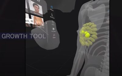 Revolutionizing Breast Health Education with 3D Organon