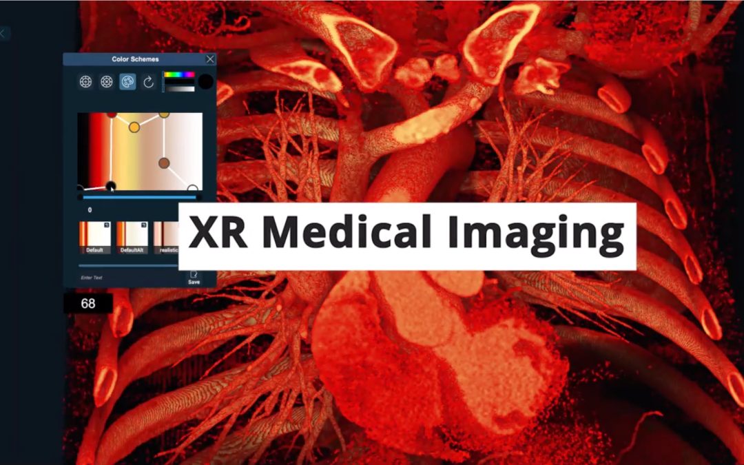 Meet the New 3D Organon!