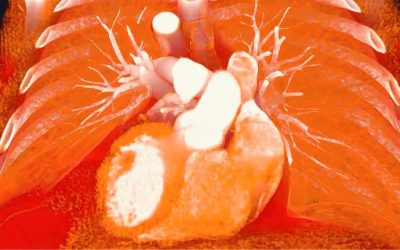 3D Organon XR Medical Imaging