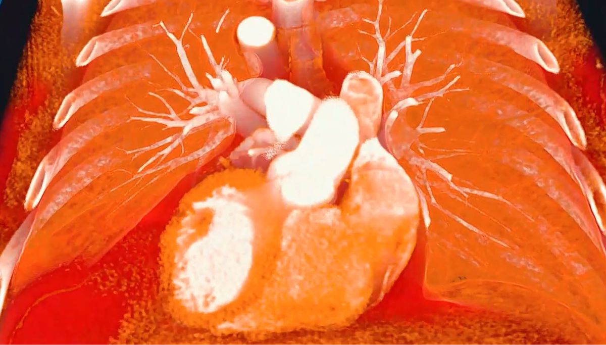 XR Medical Imaging