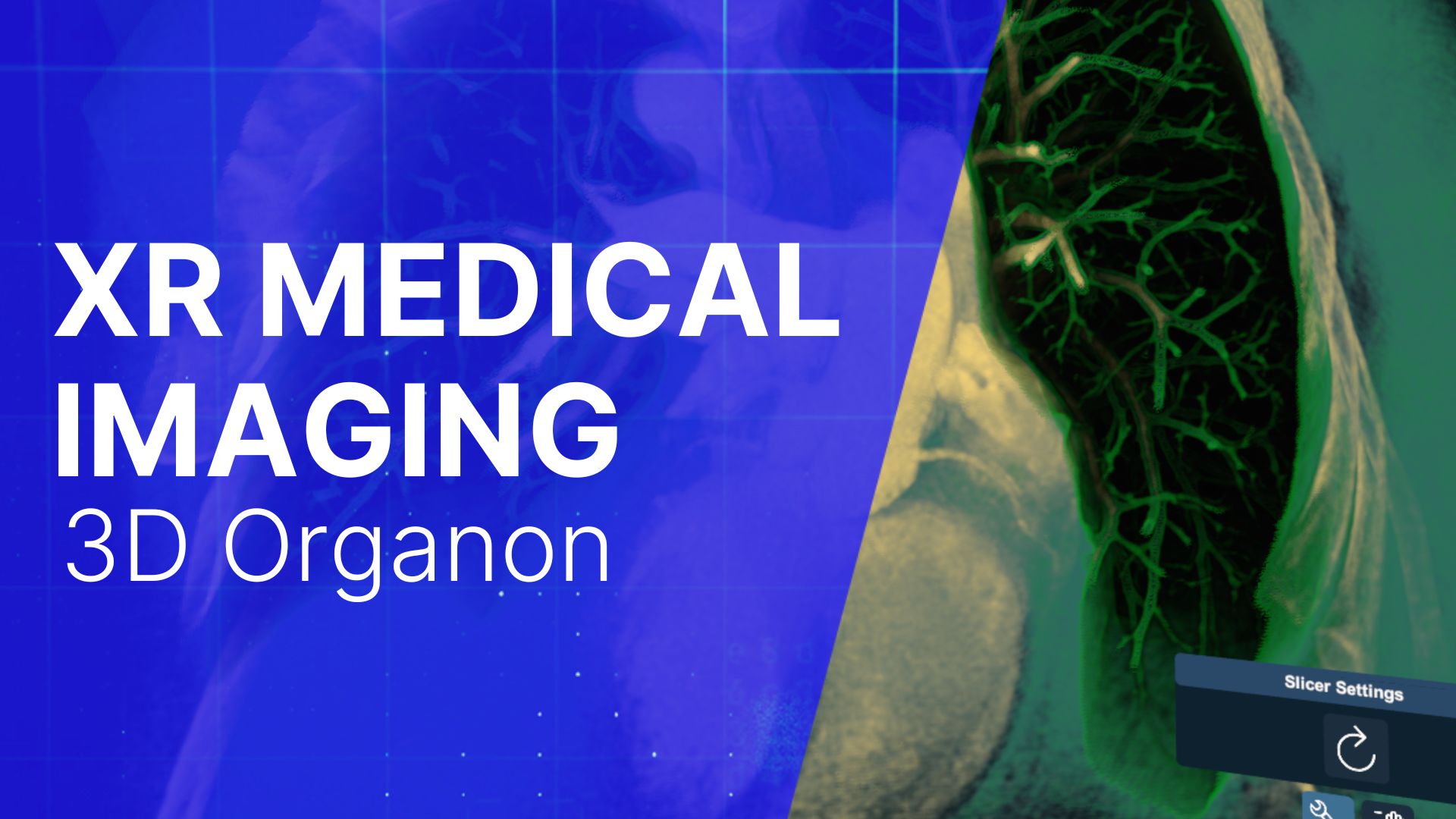 ULTRASOUND SIMULATOR(2) XR Medical Imaging
