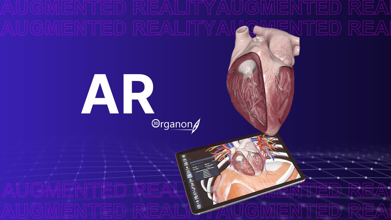 AR
