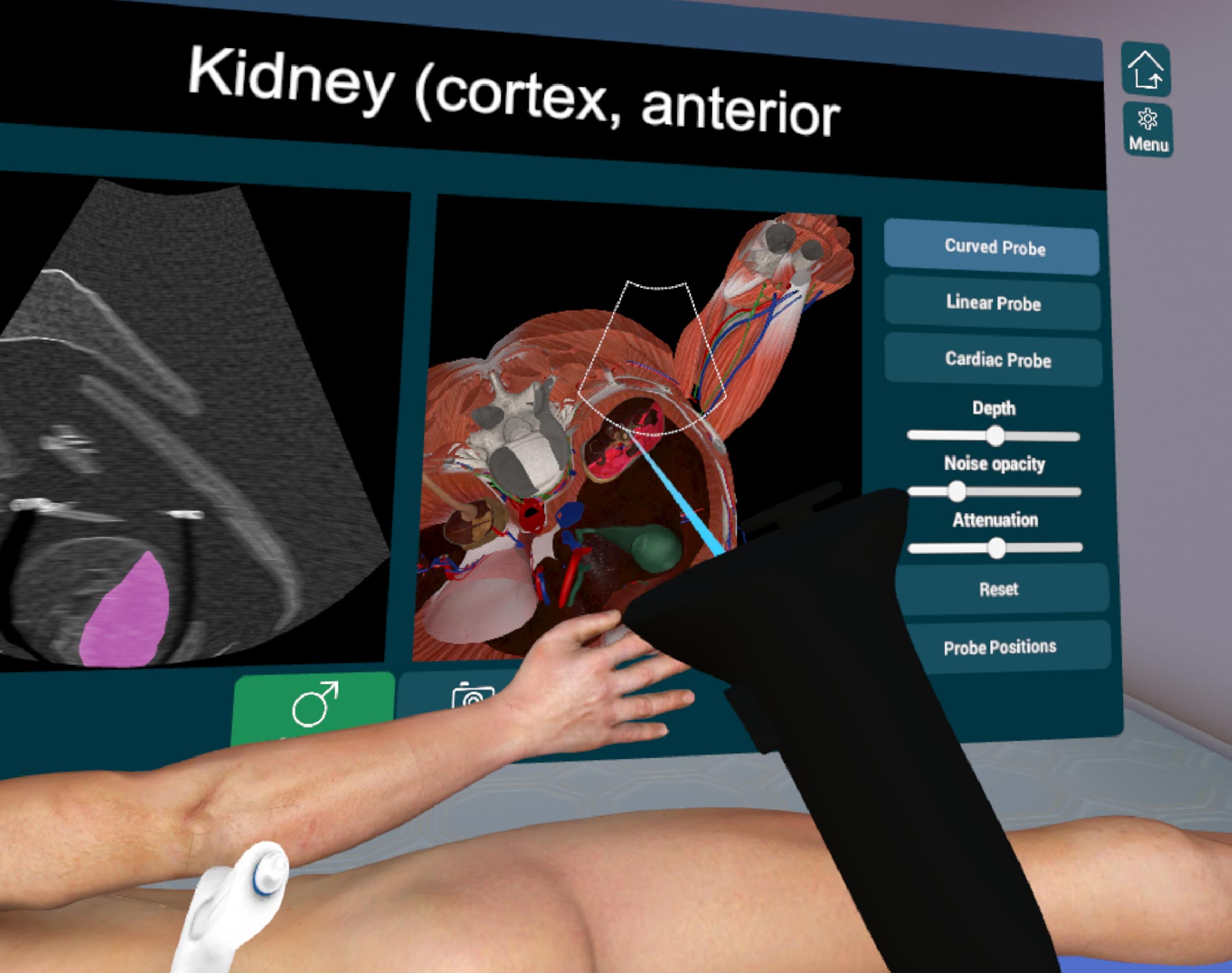 Ultrasound Simulator