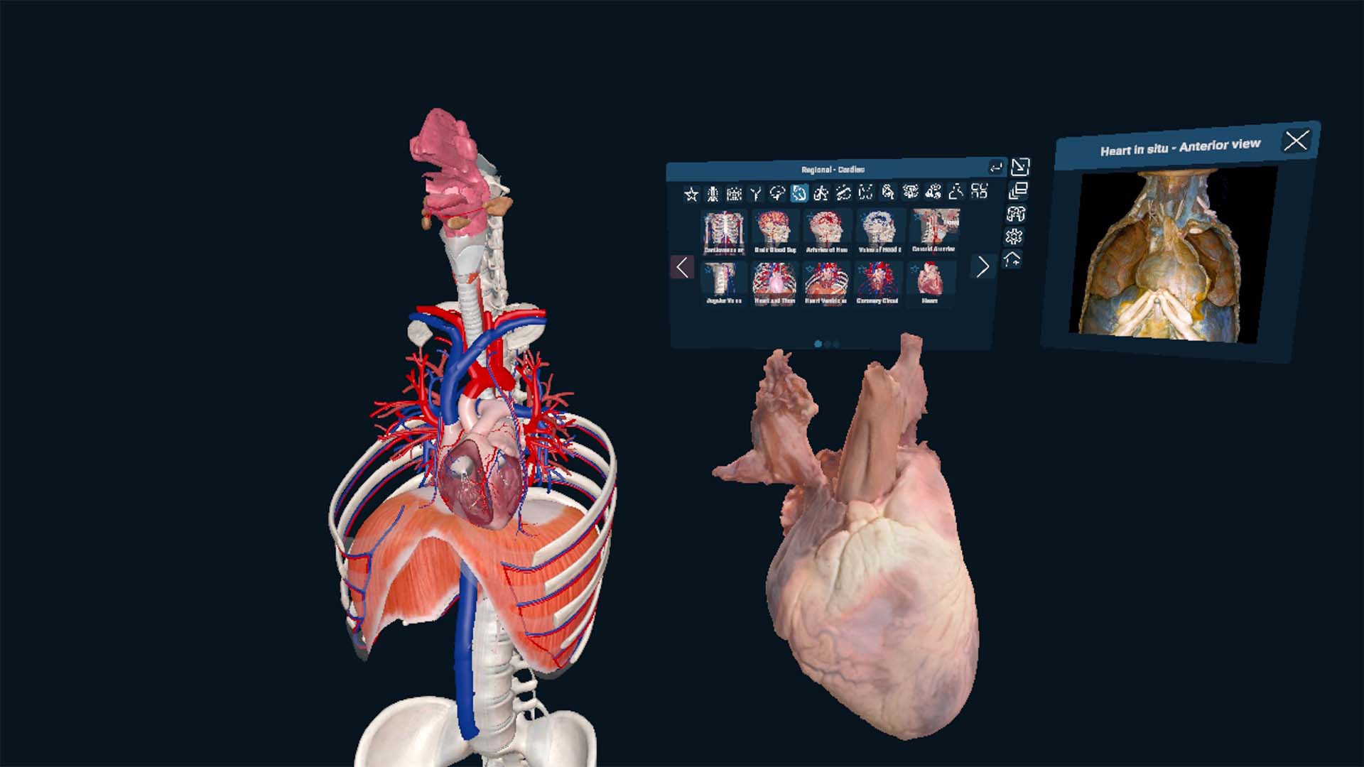 The latest 3D Organon XR update introduces new advanced features, including Multi-Model View, 3D Cadaveric Specimens, and Haptic Ultrasound. Explore the latest additions: 🔹 Multi-Model View — Work with multiple anatomical models and educational content simultaneously. 🔹 3D Cadaveric Specimens — Explore real specimens alongside 3D anatomical models. 🔹 Cloud Anatomy Content (CaaS) — Access a growing library of anatomical resources. 🔹 Single Sign-On (SSO) — Make access simpler with your organisation’s existing credentials. 🔹 Haptic Ultrasound Interactions — Experience tactile feedback for a more realistic ultrasound learning experience.