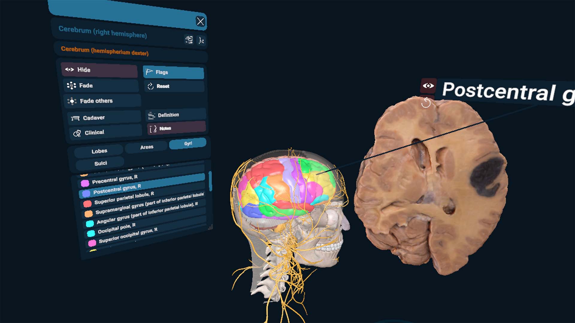 The latest 3D Organon XR update introduces new advanced features, including Multi-Model View, 3D Cadaveric Specimens, and Haptic Ultrasound. Explore the latest additions: 🔹 Multi-Model View — Work with multiple anatomical models and educational content simultaneously. 🔹 3D Cadaveric Specimens — Explore real specimens alongside 3D anatomical models. 🔹 Cloud Anatomy Content (CaaS) — Access a growing library of anatomical resources. 🔹 Single Sign-On (SSO) — Make access simpler with your organisation’s existing credentials. 🔹 Haptic Ultrasound Interactions — Experience tactile feedback for a more realistic ultrasound learning experience.